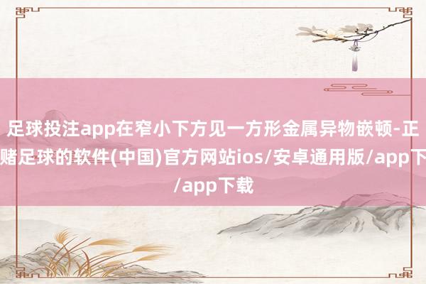 足球投注app在窄小下方见一方形金属异物嵌顿-正规赌足球的软件(中国)官方网站ios/安卓通用版/app下载
